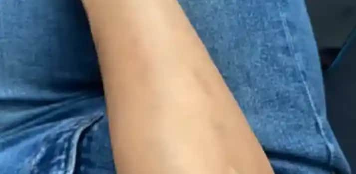 Kozmetik ve Bakımda Kol Yanığına Karşı Doğru Uygulama ve Koruma Yöntemleri