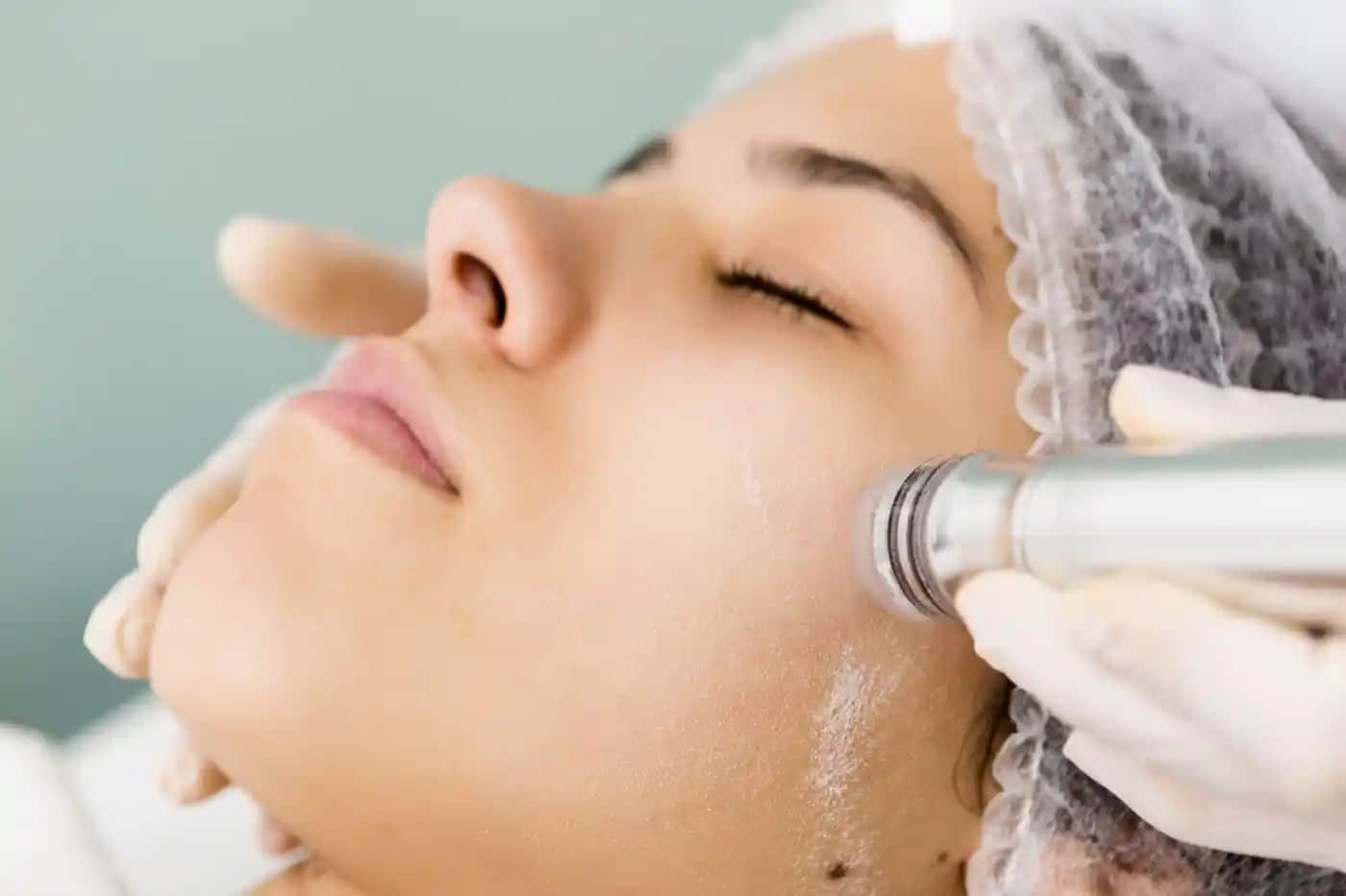 Kristal Peeling Nedir Cilt Yenileme ve Temizlik İçin Modern Bir Yöntem