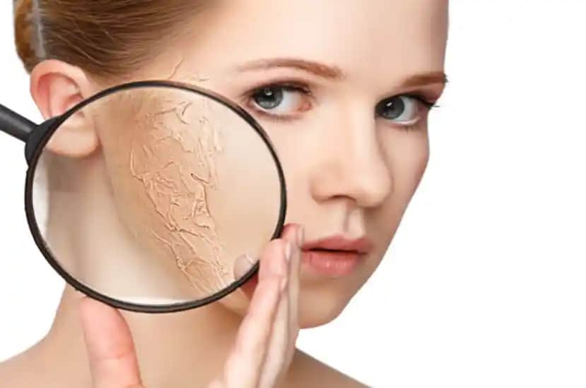 Kuru Cilt Nasıl Anlaşılır ve Doğru Bakım Yöntemleri Nelerdir