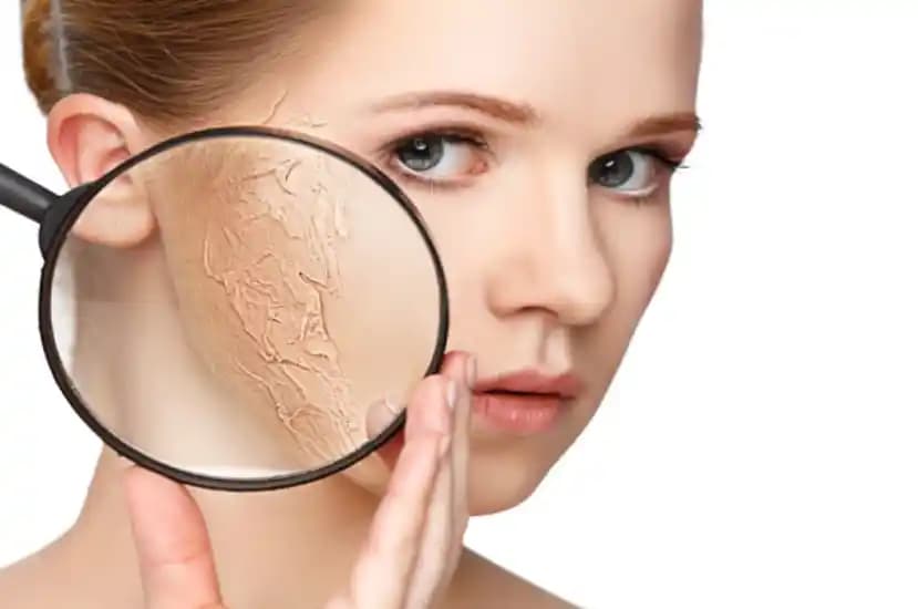 Kuru Cilt Nasıl Anlaşılır ve Doğru Bakım Yöntemleri Nelerdir