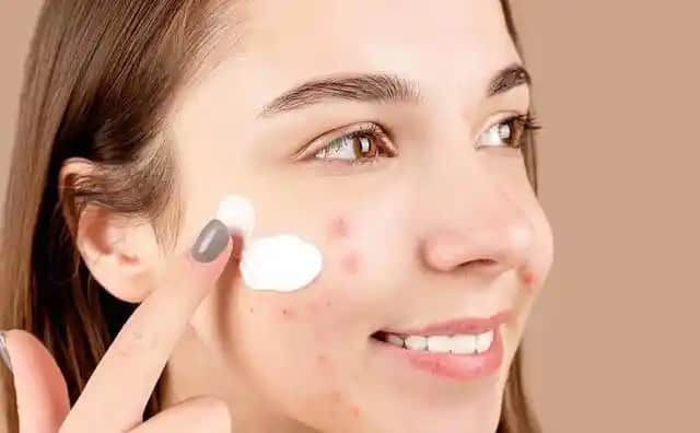 Kuru Cilt ve Sivilce İlişkisi: Doğru Bakım Yöntemleri ve Cilt Sağlığı İpuçları