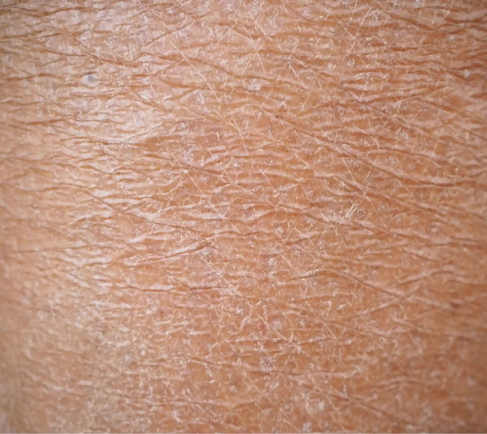 Kuru Ciltler İçin Etkili Bakım Rehberi: Nemli ve Sağlıklı Bir Cilt İçin İpuçları