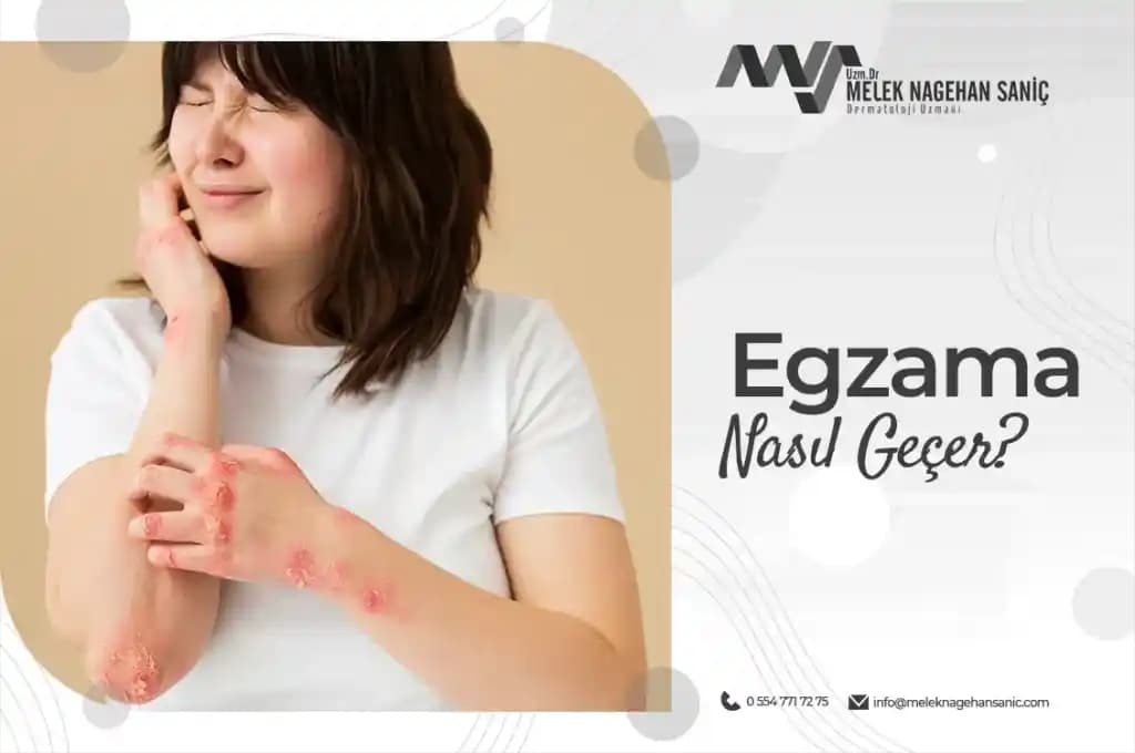 Kuru Egzama Nasıl Geçer: Etkili Yöntemler ve Günlük Bakım İpuçları