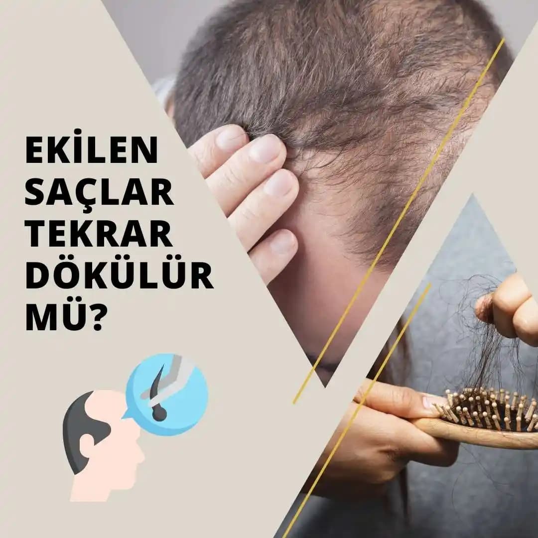 Kuru Saçlar ve Saç Dökülmesi: Nedenleri, Etkileri ve Koruma Yöntemleri