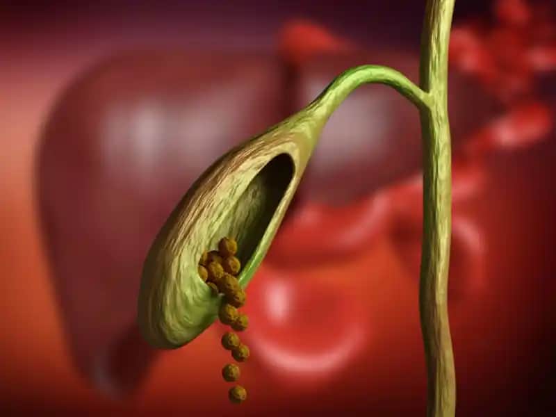 Lazer Kesesi Nedir ve Güzellik Sektöründe Nasıl Bir Rol Oynar