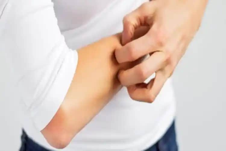 Lazer Tedavileri Sonrası Ciltte Oluşabilecek Reaksiyonlar ve Kaşıntı Sorunu