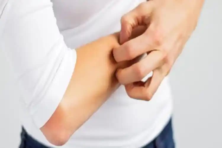 Lazer Tedavileri Sonrası Ciltte Oluşabilecek Reaksiyonlar ve Kaşıntı Sorunu