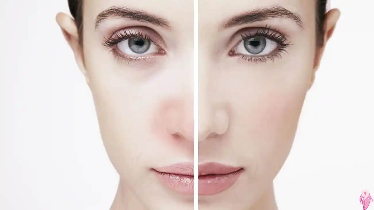 Makyaj Alerjisi Nedir, Belirtileri ve Korunma Yöntemleri Hakkında Detaylı Bilgi