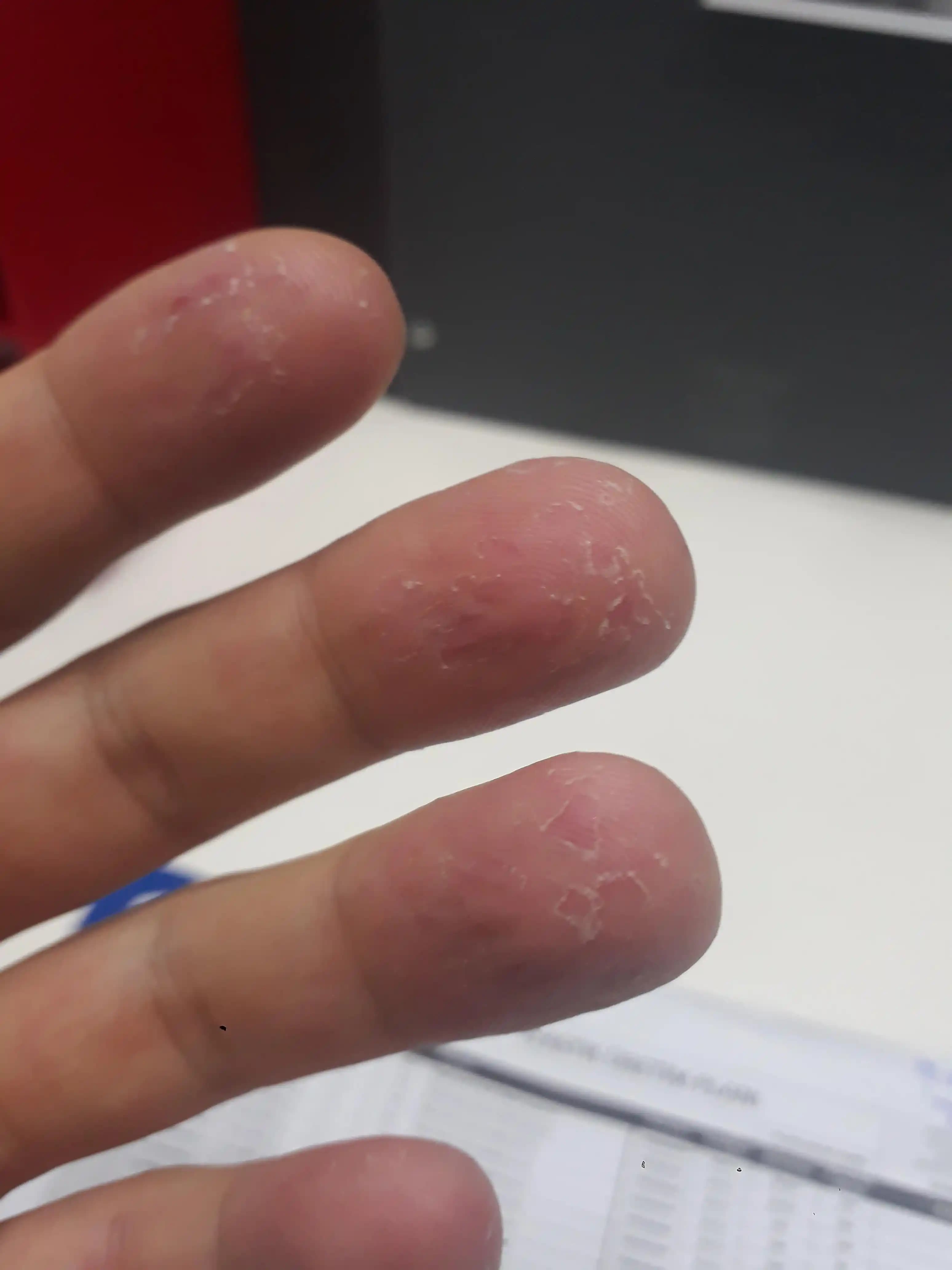 Mevsimsel Egzama ve Kozmetik Bakım Yöntemleri Cilt Sağlığını Koruma Rehberi