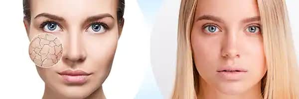 Normal Cilt Tipi İçin Günlük Bakım Rutinleri ve Doğru Ürün Seçimi Rehberi