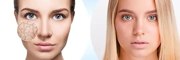 Normal Cilt Tipi İçin Günlük Bakım Rutinleri ve Doğru Ürün Seçimi Rehberi