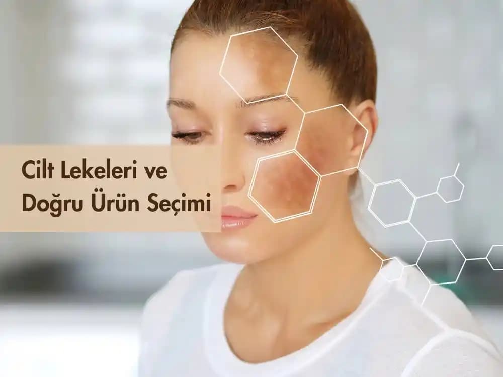 Postinflamatuar Hiperpigmentasyon Tedavisi ve Güncel Kozmetik Yaklaşımlar