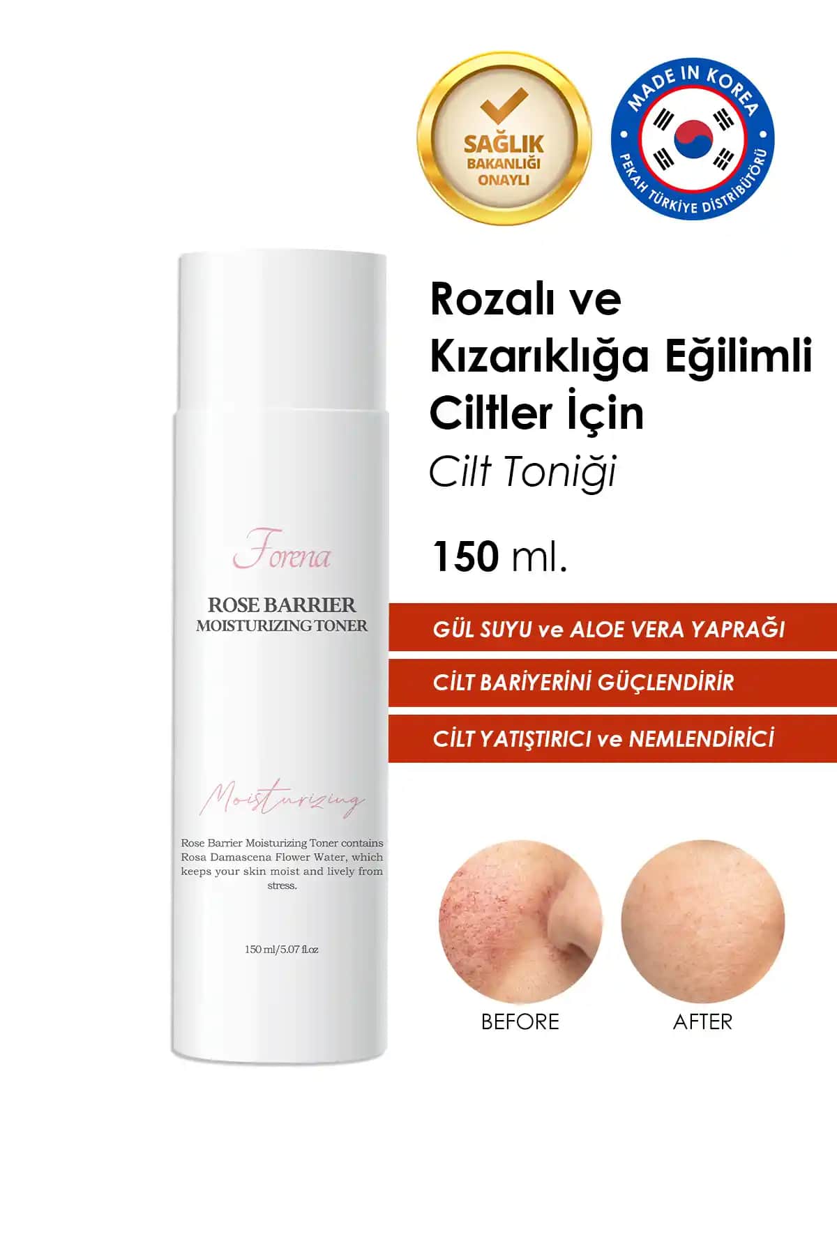 Rozalı Ciltler İçin En Uygun Tonik Seçimi ve Kullanımı Cilt Sağlığını Destekleyen Yatıştırıcı Ürünler