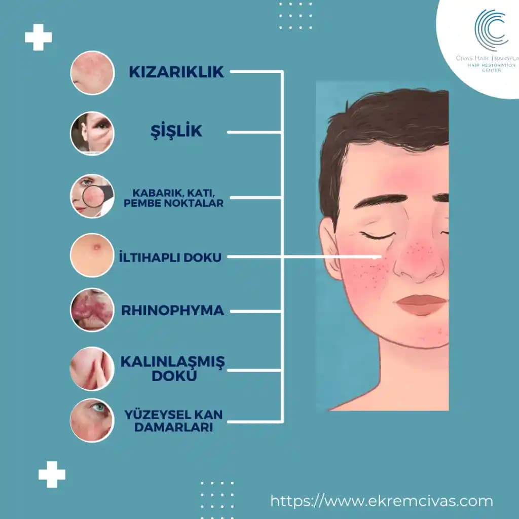 Rozasea Çeşitleri ve Kozmetik Endüstrisindeki Yeri Hakkında Detaylı Bilgi