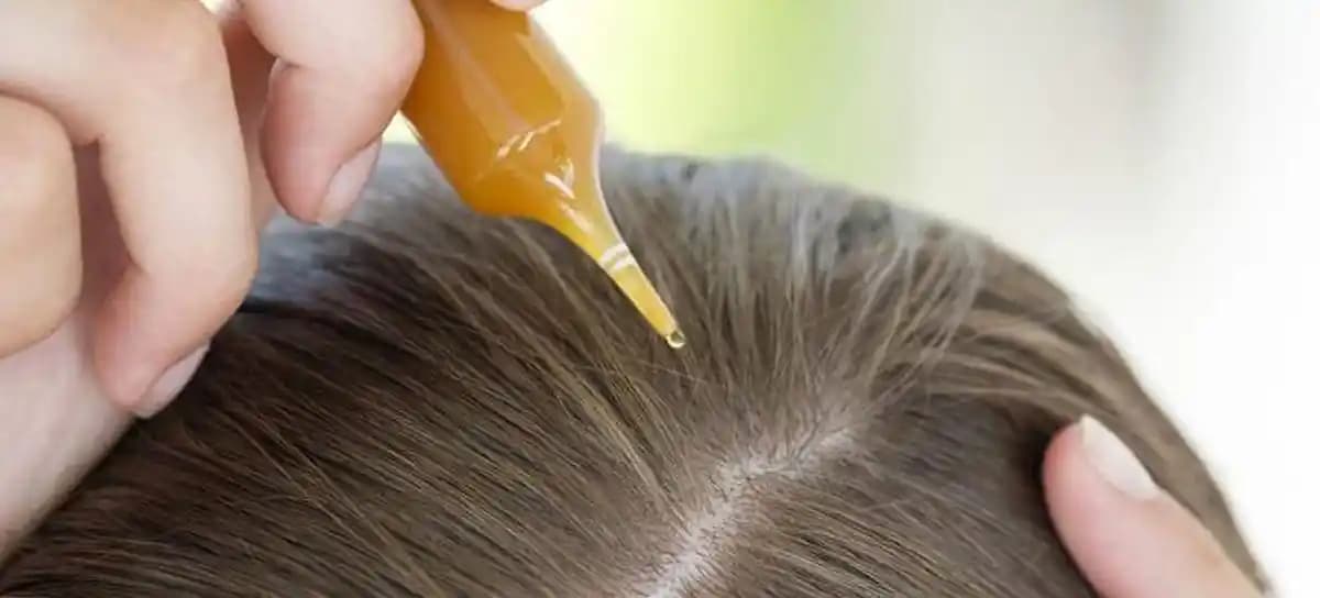 Saç Çıkarmada En Etkili Doğal Yağlar ve Kullanım Yöntemleri