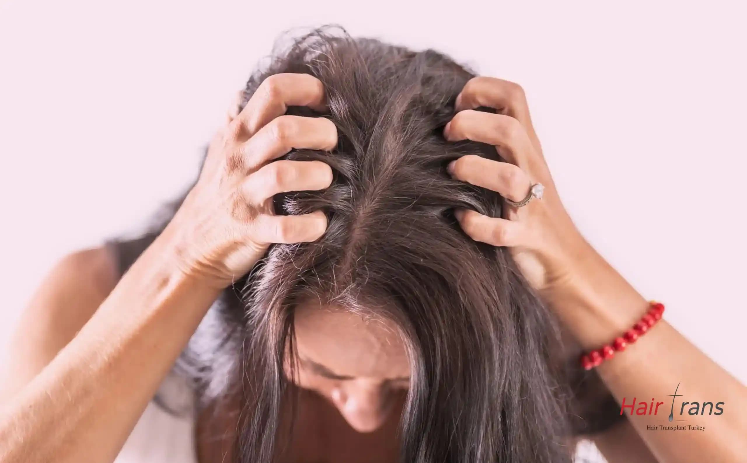 Saç Derisi Ağrısının Nedenleri ve Rahatlatıcı Çözüm Yöntemleri