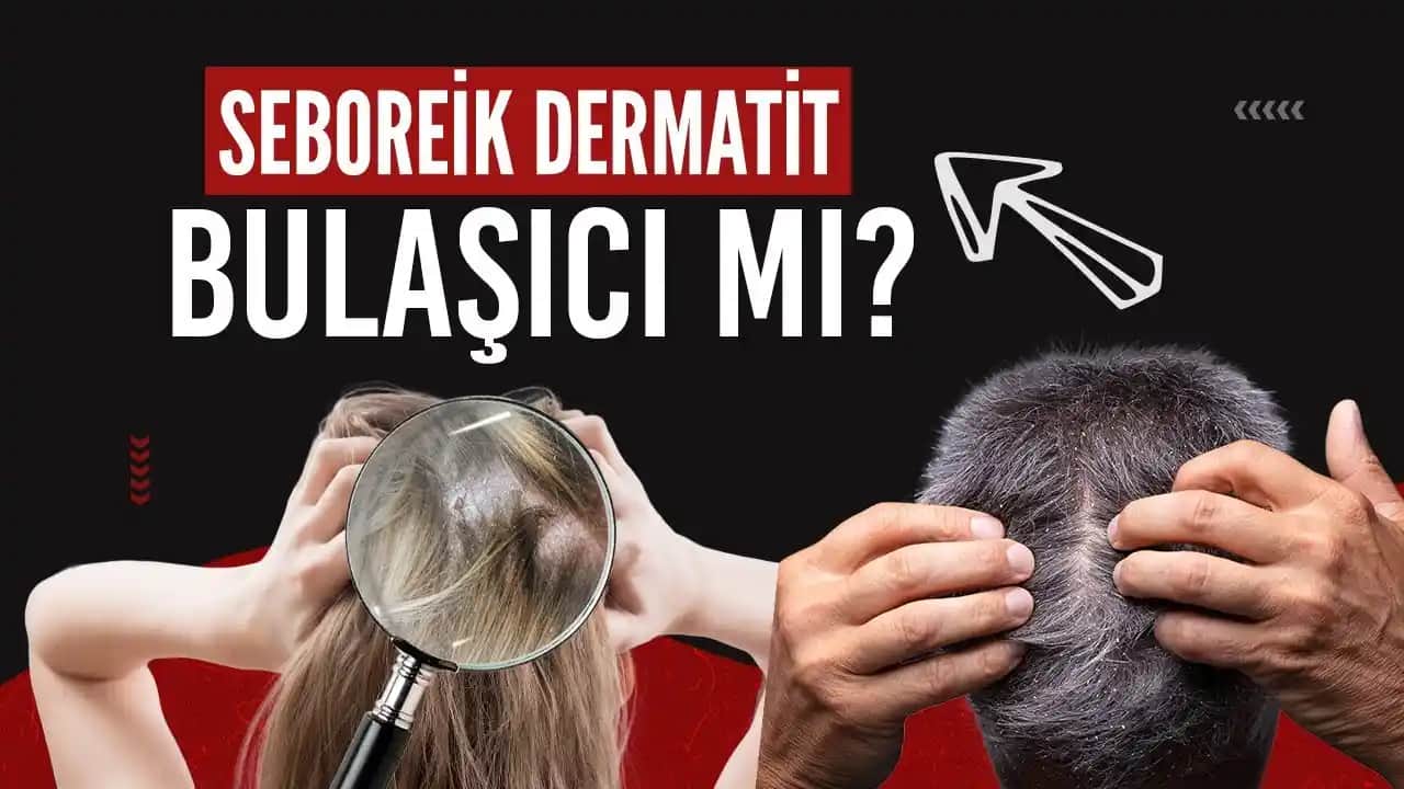 Saç Derisi Yaraları Nedenleri Belirtileri ve Etkili Tedavi Yöntemleri