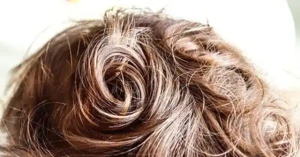 Saç Derisinin Ağrıması Nedenleri Belirtileri ve Çözüm Yolları Hakkında Kapsamlı Rehber