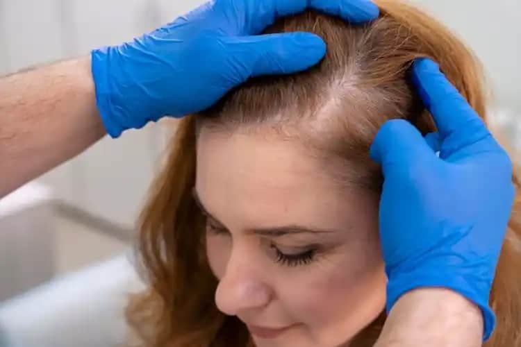 Saç Derisinin Kızarması Nedenleri ve Sağlıklı Bakım Yöntemleri Rehberi