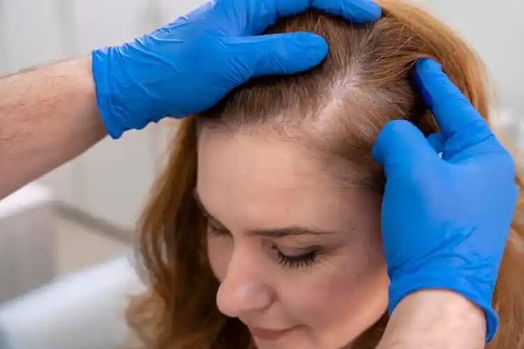 Saç Derisinin Kızarması Nedenleri ve Sağlıklı Bakım Yöntemleri Rehberi