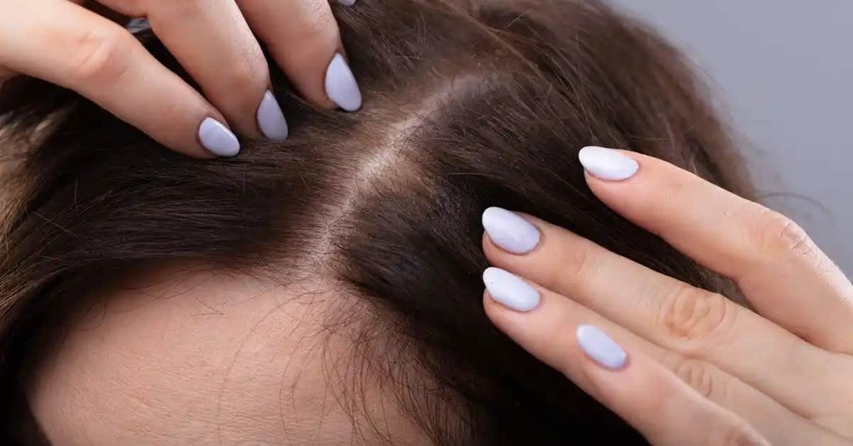 Saç Dibi Kaşıntısının Nedenleri ve Doğal Çözüm Yöntemleri Hakkında Kapsamlı Rehber