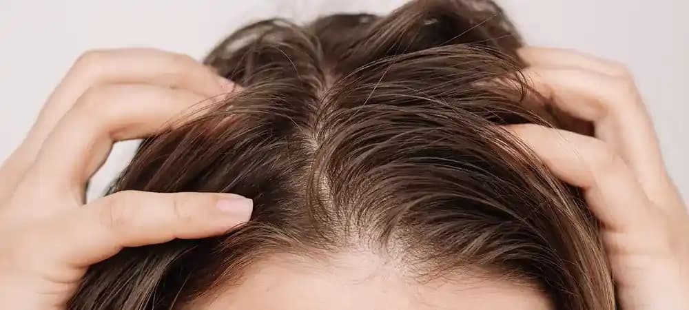 Saç Dibi Yağlanması Nedenleri ve Etkili Çözüm Yolları Hakkında Kapsamlı Rehber