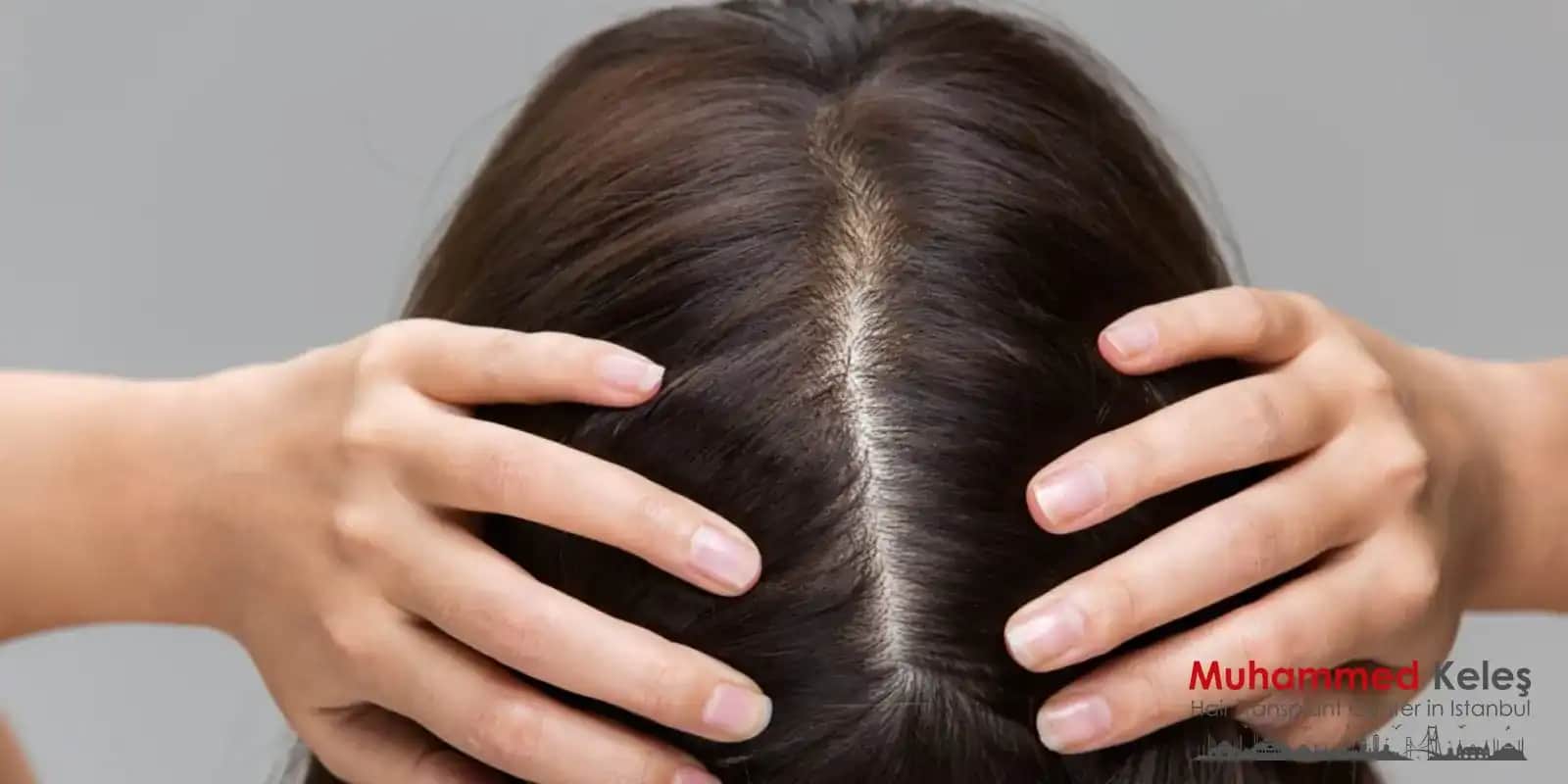 Saç Dipleri Ağrısının Nedenleri ve Sağlıklı Saçlar İçin Alınacak Önlemler