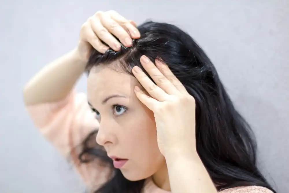 Saç Diplerinde Sivilce Nedenleri ve Etkili Çözüm Yolları Hakkında Kapsamlı Bilgi