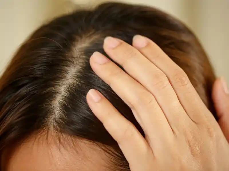 Saç Diplerindeki Acımanın Nedenleri ve Sağlıklı Bakım Yöntemleri