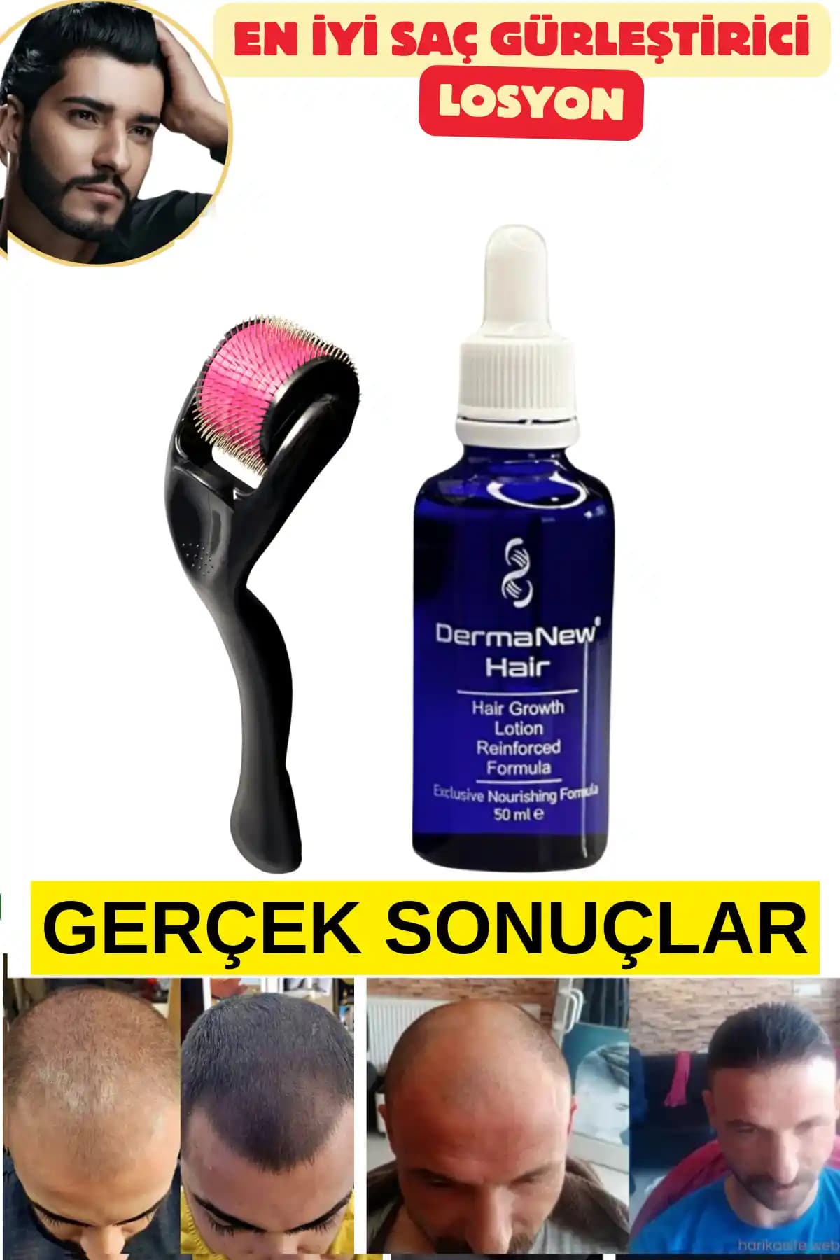 Saç Gürleştirici Ürünler ve Doğru Kullanım Yöntemleri Rehberi