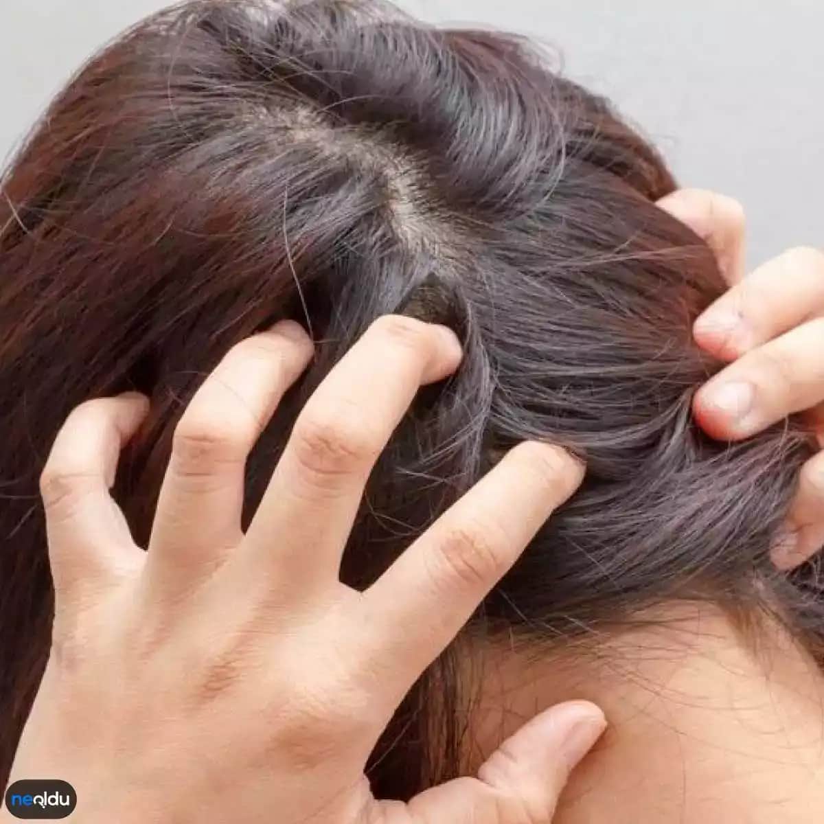 Saç Kaşıntısının Nedenleri ve Etkili Çözüm Yöntemleri Hakkında Detaylı Bilgi