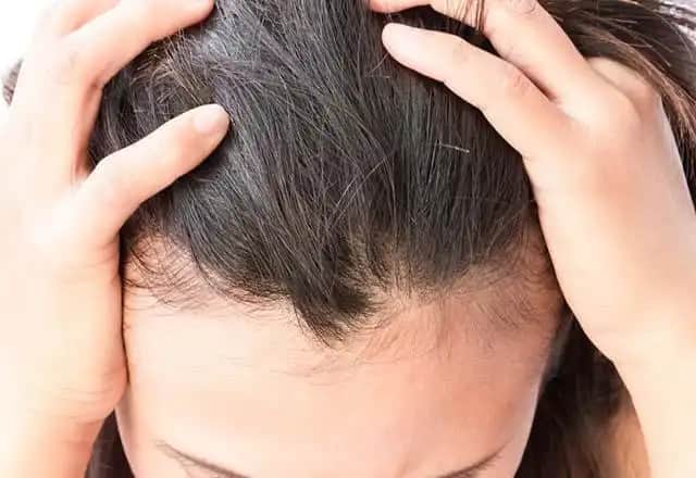 Saç Nezlesi Nedenleri ve Korunma Yöntemleri Hakkında Detaylı Bilgi