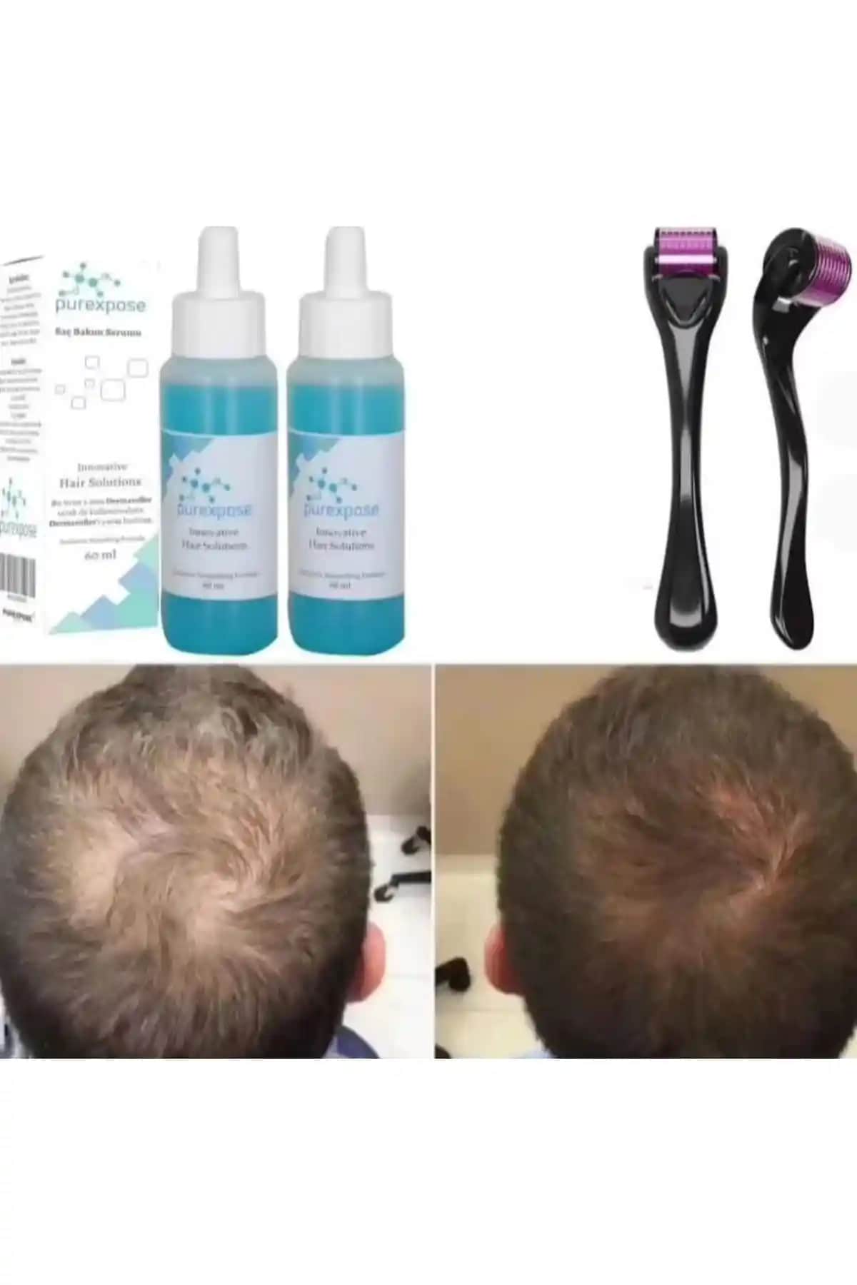 Saç Rolonu Kullanımı ve Avantajları: Pratik Şekillendirme Yöntemleri