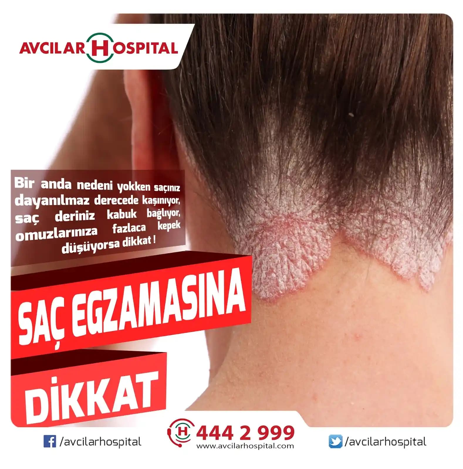 Saçlarda Kaşıntı ve Dökülmenin Nedenleri ve Etkili Çözüm Yöntemleri