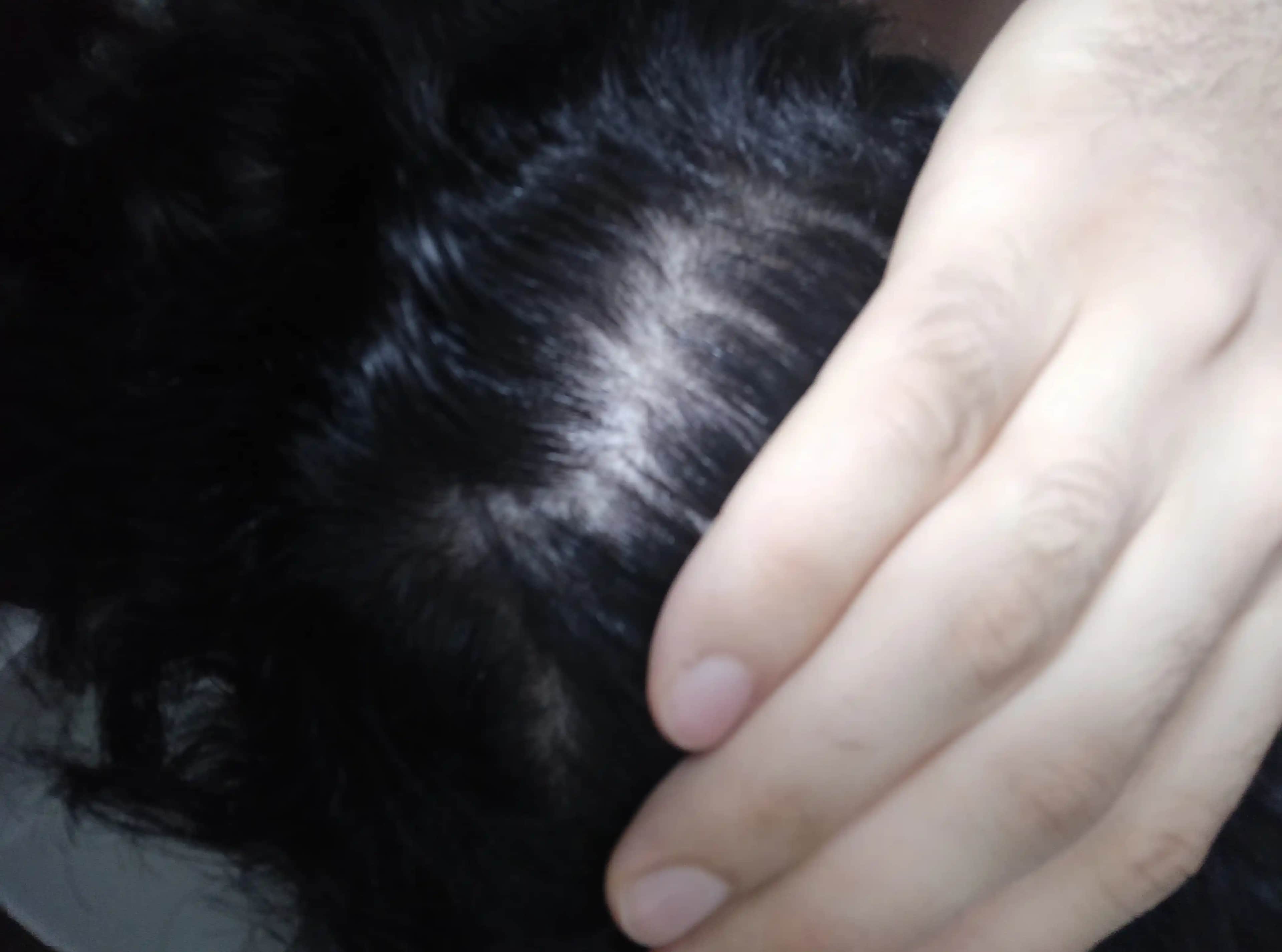 Saçta Kaşıntı ve Dökülme Nedenleri ile Doğal ve Etkili Çözüm Yolları