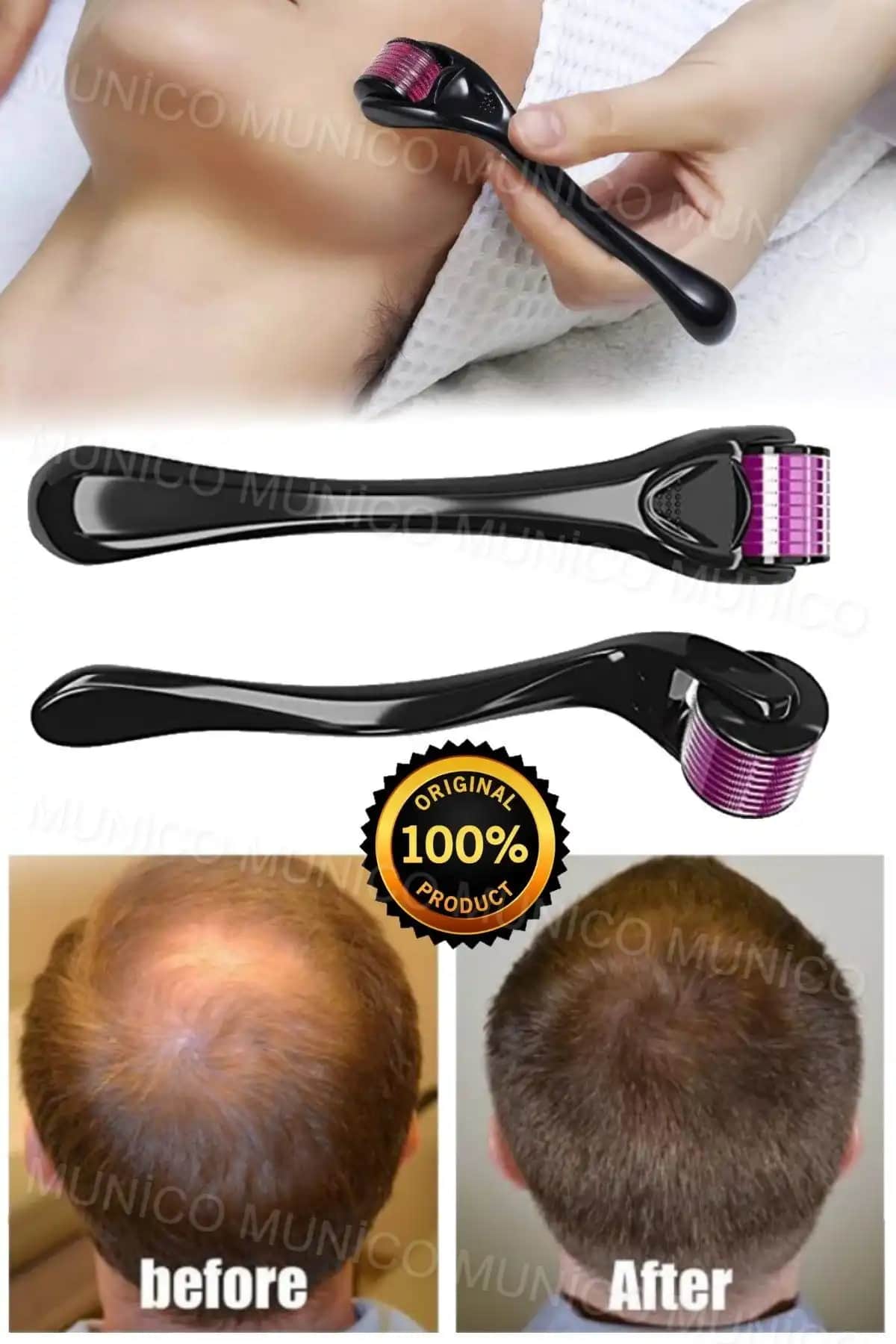 Sakal Çıkarıcı Roller ile Sakal Bakımında Yeni Trendler ve Kullanım İpuçları