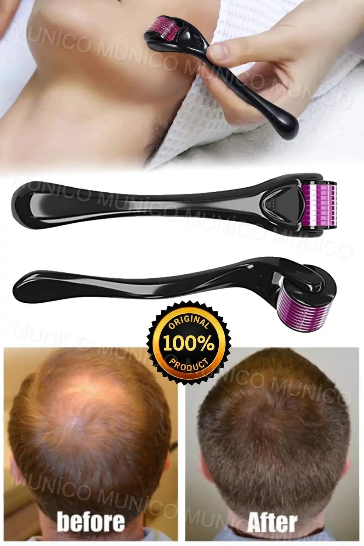 Sakal Çıkarıcı Roller ile Sakal Bakımında Yeni Trendler ve Kullanım İpuçları