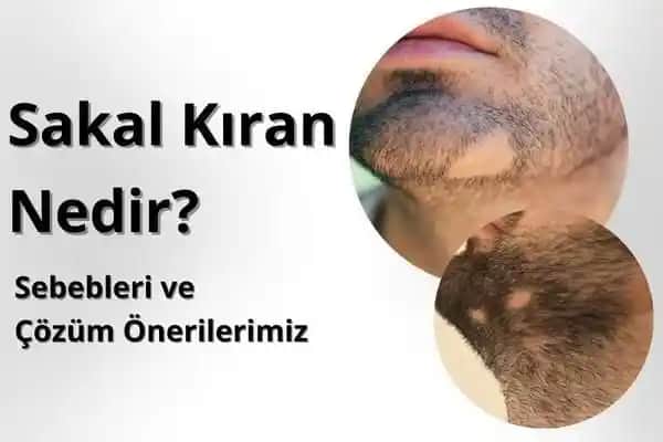 Sakal Kıran Nedir, Belirtileri ve İyileşme Sürecinde Gözlemlenen İşaretler