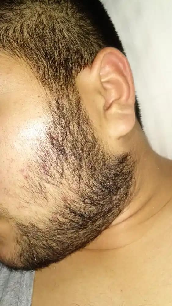 Sakalın Sertleşmesini Sağlayan Etkenler ve Erkek Bakımında Uygulanabilir Yöntemler