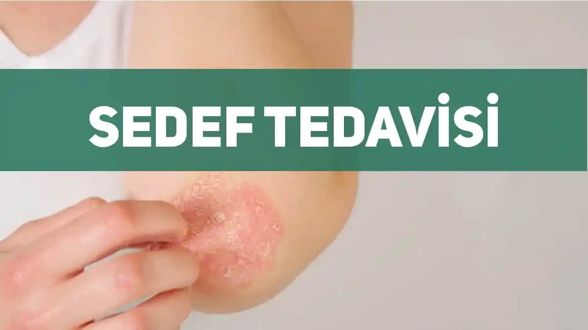 Sedef Hastalığının Kozmetik Dünyasındaki Yeri ve Güncel Tedavi Yaklaşımları