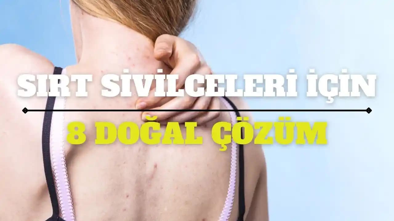 Sırt Sivilcesiyle Mücadele ve Etkili Bakım Yöntemleri Rehberi