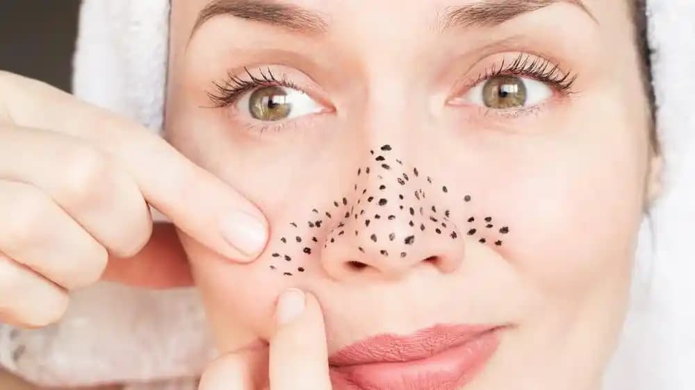 Sırtta Siyah Nokta Temizliği ve Bakım Yöntemleri: Etkili Çözümler ve İpuçları