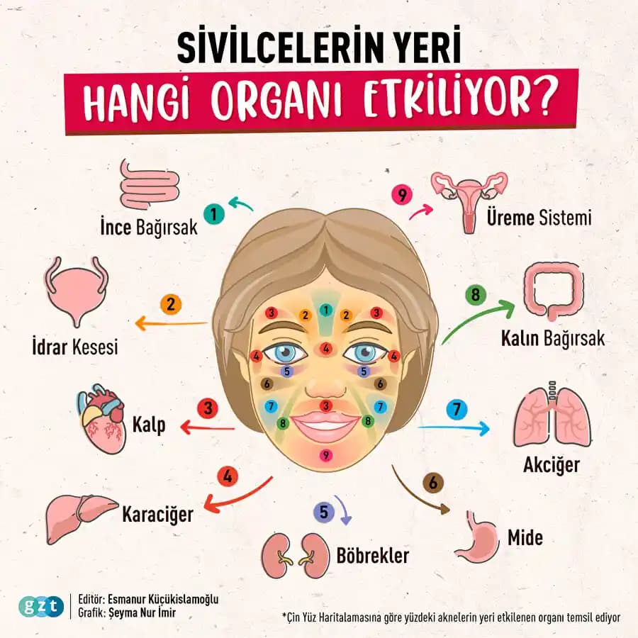 Sivilce Çıkan Bölgelerin Nedenleri ve Cilt Sağlığını Koruma Yöntemleri