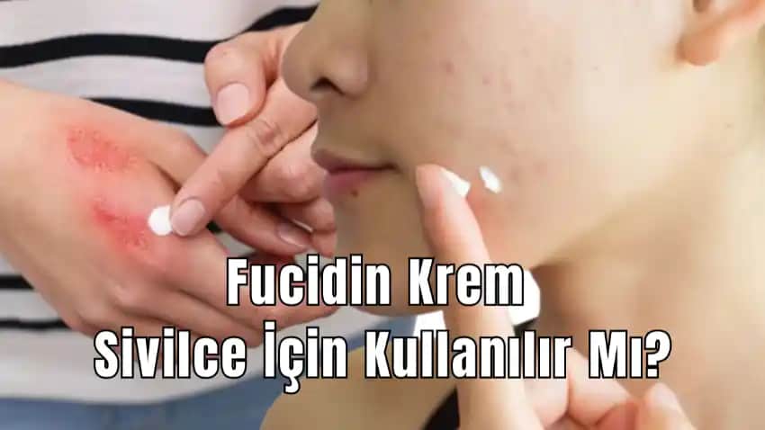 Sivilce İzlerini Azaltan Etkili Yöntemler ve Cilt Yenileme Teknikleri