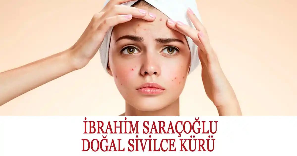 Sivilce Kürü ve Cilt Sağlığı İçin Güncel Kozmetik Yöntemler ve Doğal Çözümler