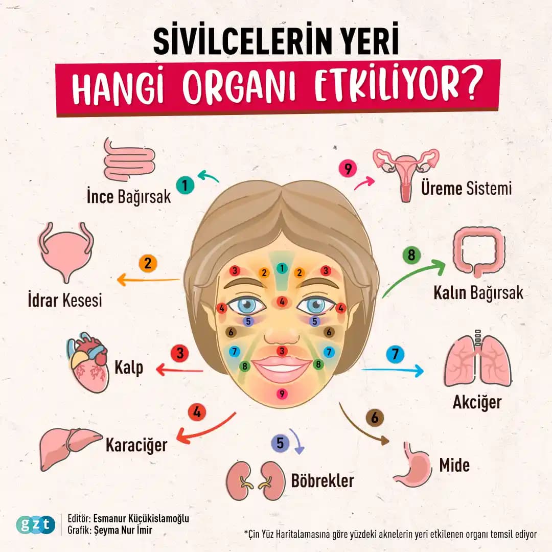 Sivilce Nedenleri ve Sağlıklı Cilt İçin Bilmeniz Gerekenler