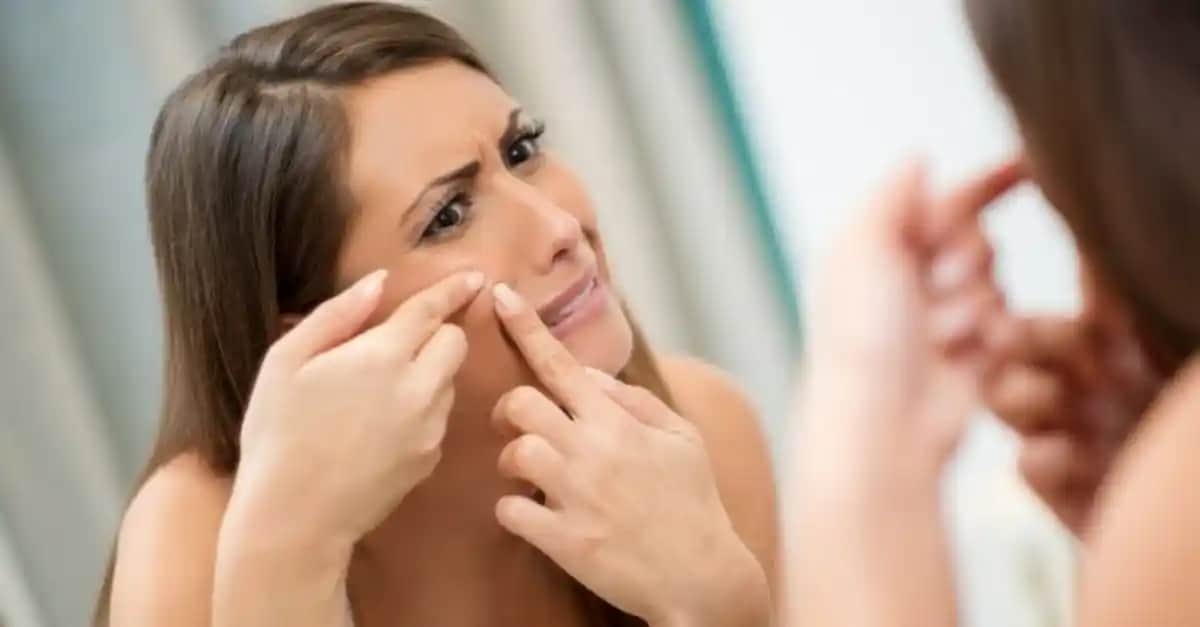 Sivilce Oluşumunu Engelleyen Besinler ve Cilt Sağlığını Destekleyen En İyi Gıdalar