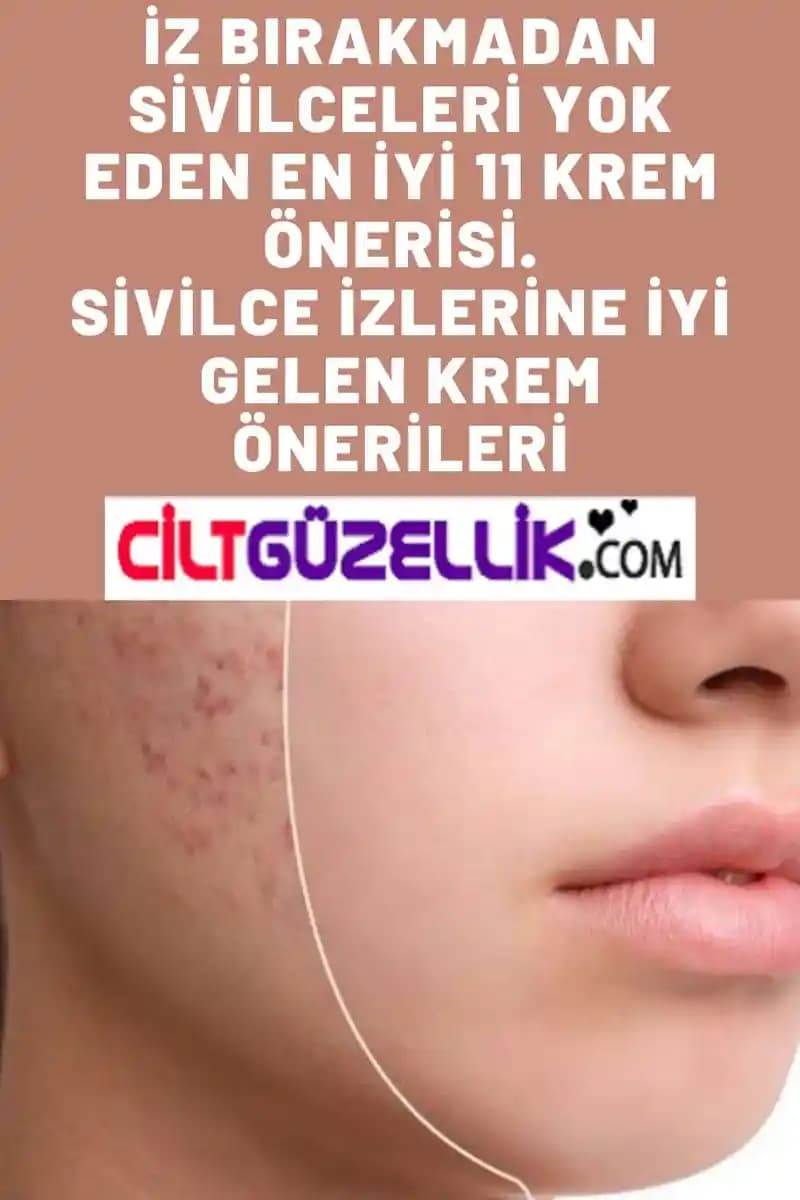 Sivilce ve Cilt Bakımı İçin Uzman Tavsiyeleri ve Etkili Yöntemler