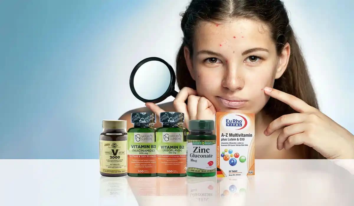 Sivilceler İçin Hangi Vitaminler: Cilt Sağlığını Destekleyen Doğru Vitamin Seçenekleri