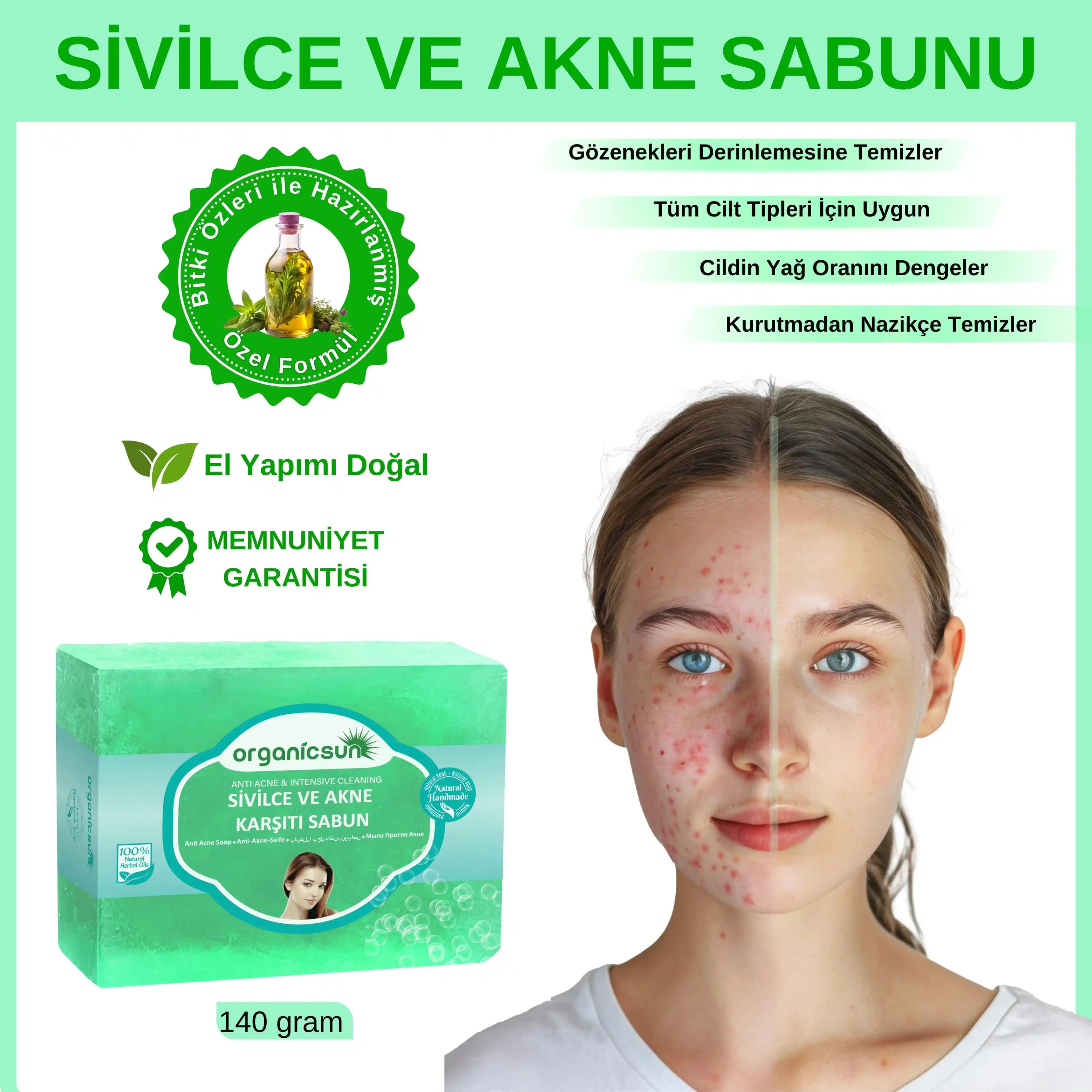 Sivilceyle Mücadelede En İyi Sabunlar ve Cilt Sağlığı İçin Doğru Seçenekler